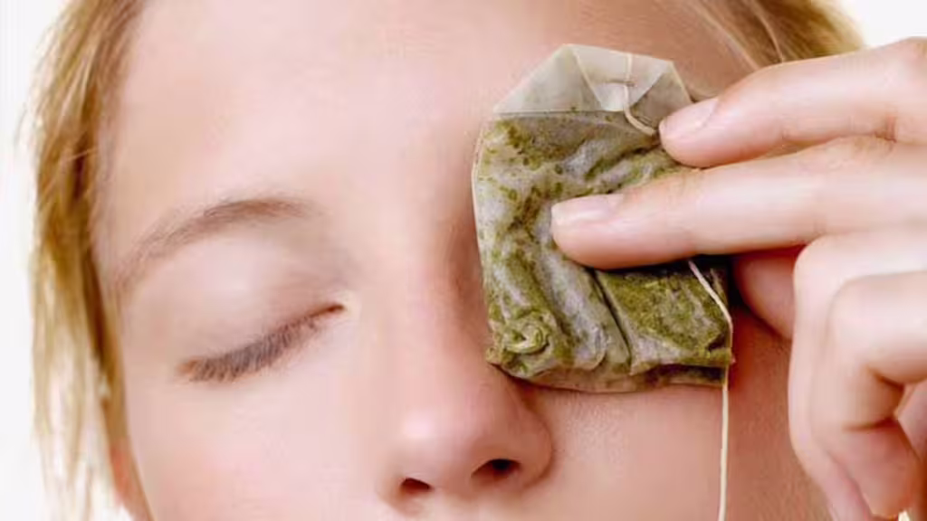 Descubre 7 Remedios Naturales para Reducir las Ojeras