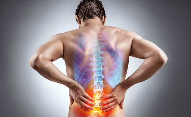 Espondilitis Anquilosante en Chile: Un Desafío de Diagnóstico y Tratamiento