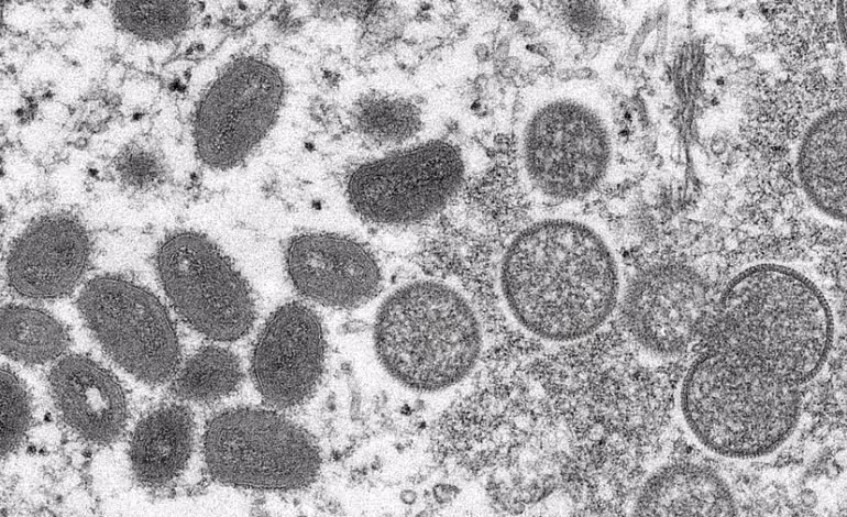 Suecia confirma primer caso de viruela del mono fuera de África; Madrid solicita controles en el aeropuerto