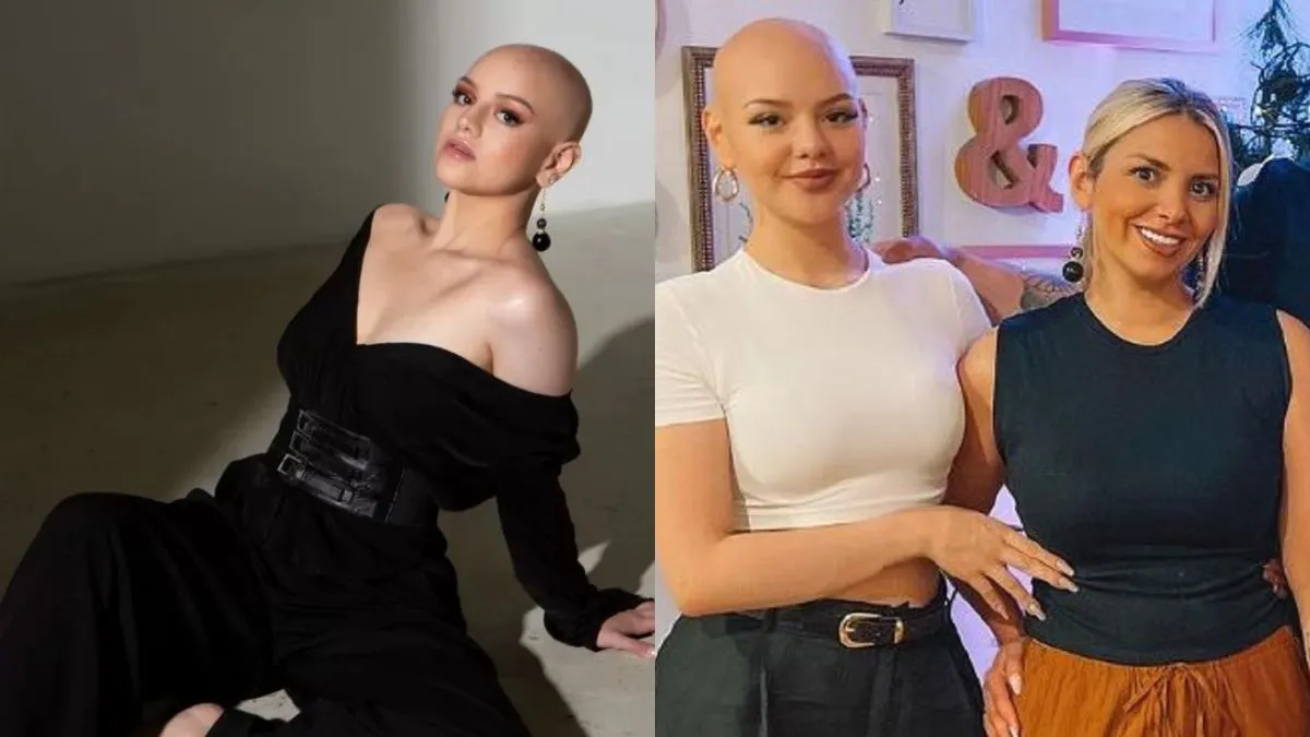 Isidora Carvallo revela su lucha contra la alopecia y su deseo de inspirar con su historia