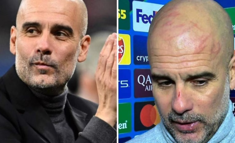 Guardiola sorprende con lesiones tras empate del City: “Quería hacerme daño”