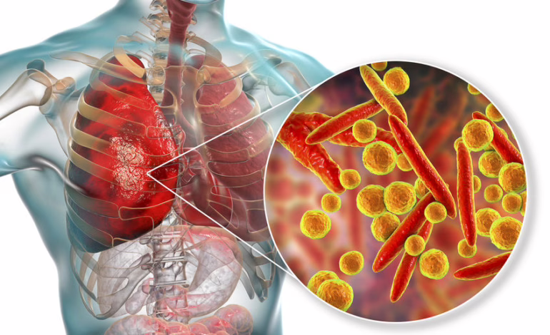 Minsal refuerza medidas para prevenir el contagio de Mycoplasma: ventilación y lavado de manos como claves