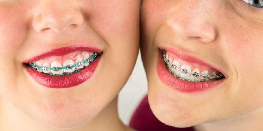 La ortodoncia en adolescentes: un impacto más allá de la estética