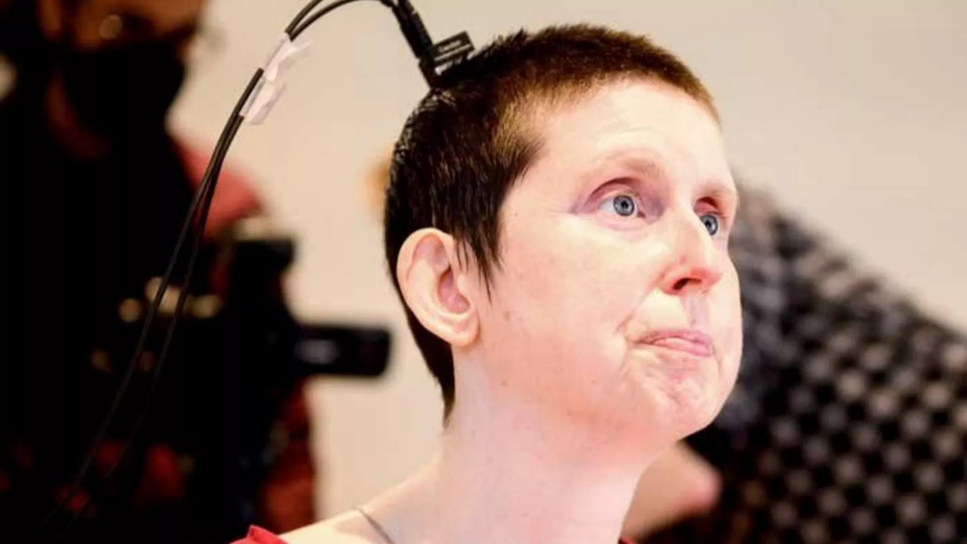 Implante cerebral experimental permite a mujer recuperar el habla tras 18 años