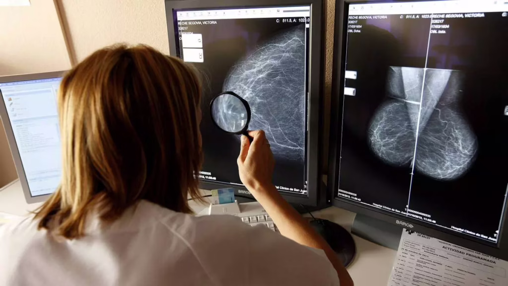 Avance histórico: nuevo tratamiento logra 100% de supervivencia en cáncer de mama hereditario